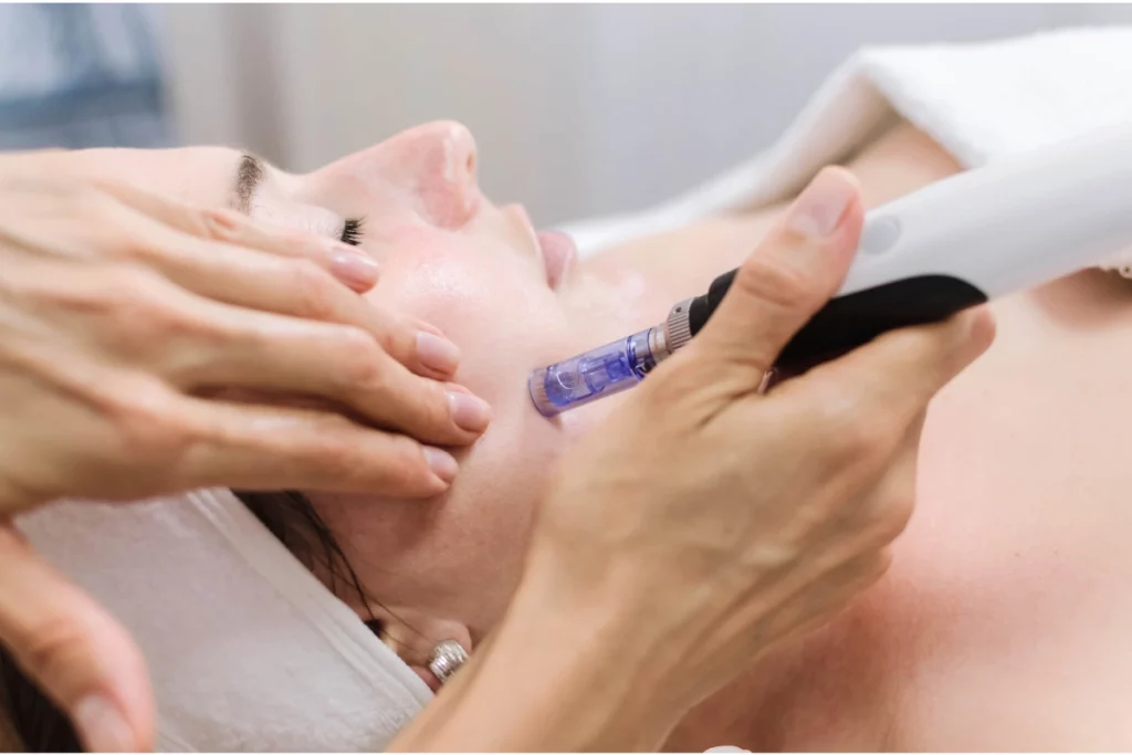 Woman receiving a microneedling facial treatment in Tulsa, OK