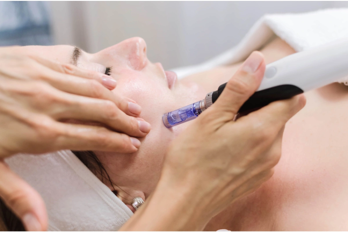 Woman receiving a microneedling facial treatment in Tulsa, OK
